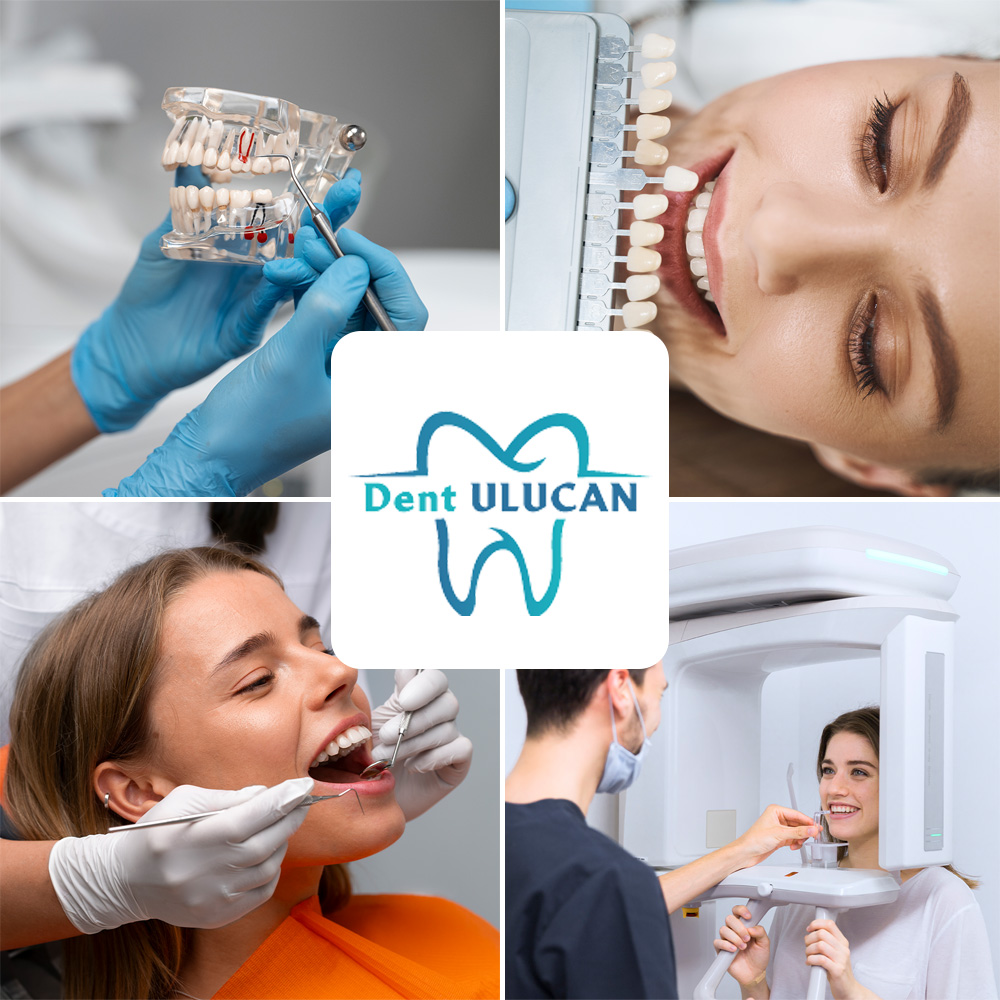 ÖZEL DENT ULUCAN - AĞIZ VE DİŞ SAĞLIĞI POLİKLİNİĞİ Hakkımızda